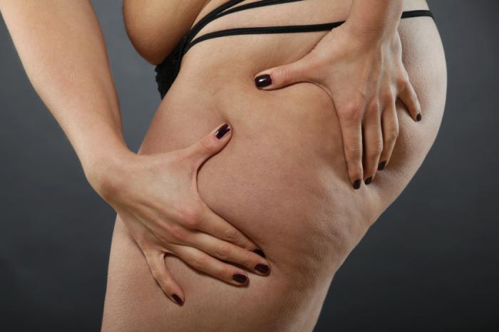 Is it easier to lose weight after liposuction?